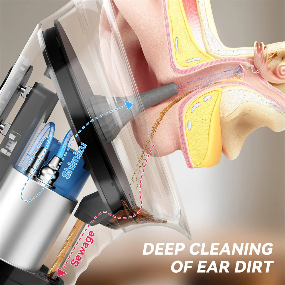 Safely Remove Ear Wax at Home with Gentle Water Cleaning 👂💧